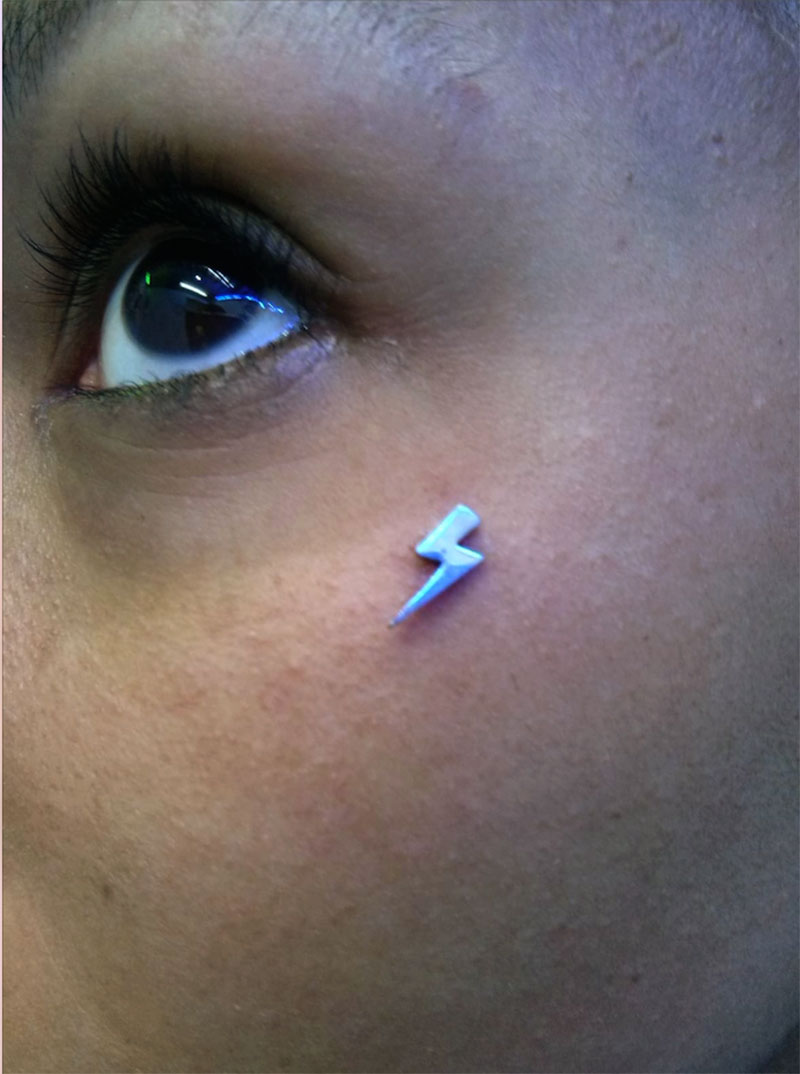 Piercing-microdermal-rayo